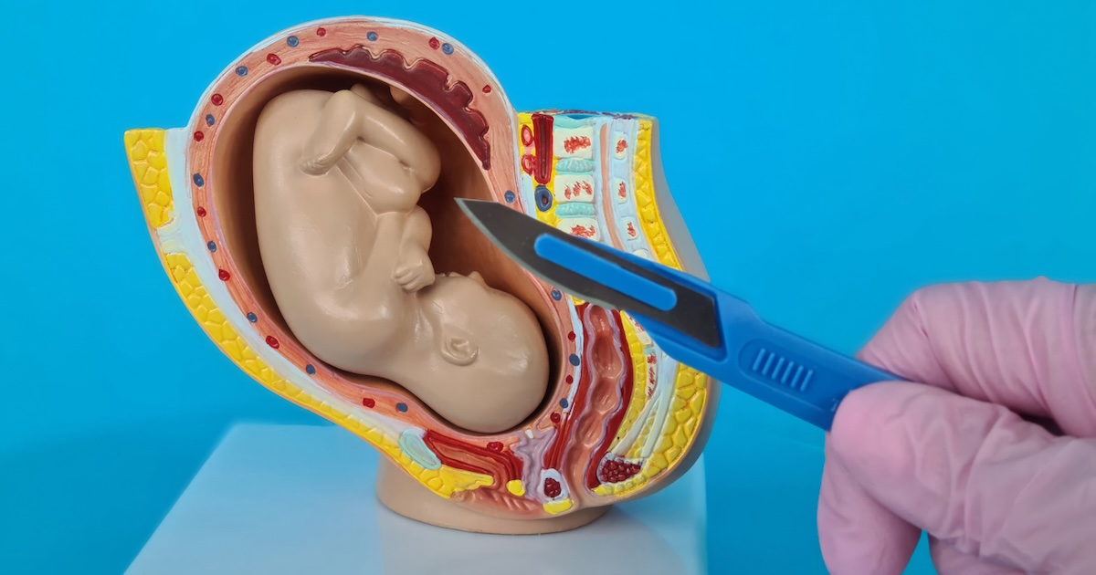 abortion baby prolife